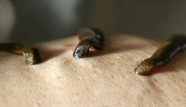 les sangsues de la république les sangsues de la république