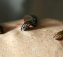 les sangsues de la république les sangsues de la république